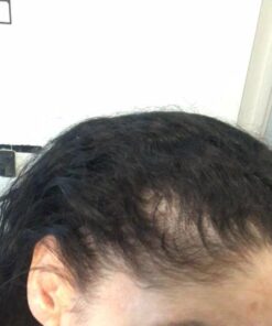 Hairgenics Propidren Hair Growth Shampoo for Thinning and Balding Hair with Biotin , Keratin, and Powerful DHT Blockers to Prevent Hair Loss, Nourish and Stimulate Hair Follicles and Help Regrow Hair. 24 416WuI1NL