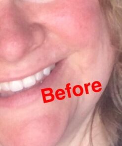 Organic Rosehip Oil – 100% Pure Unrefined Cold Pressed Rosehip Seed Oil - Best Moisturizer for Face, Hair - Great for Fine Lines, Wrinkles, Acne Scars, Sun Damage, Stretch Marks, Eczema, Psoriasis 4 Fl Oz (Pack of 1) 41 417yEYD9aL