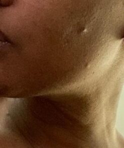 TruSkin Tea Tree Clear Skin Super Serum, Formulated with Tea Tree Oil, Vitamin C, Salicylic Acid, Niacinamide & Retinol, 1fl oz 1 Fl Oz (Pack of 1) 55 4198Oanvt6L 1