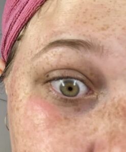 Active Skin Repair Hydrogel - Natural & Non-Toxic First Aid Ointment & Antiseptic Gel for Minor Cuts, Wounds, Scrapes, Rashes, Sunburns, and Other Skin Irritations (Single, 3 oz Gel) 3 Fl Oz (Pack of 1) 48 41BRvV8UZGL