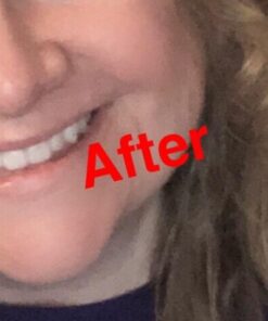 Organic Rosehip Oil – 100% Pure Unrefined Cold Pressed Rosehip Seed Oil - Best Moisturizer for Face, Hair - Great for Fine Lines, Wrinkles, Acne Scars, Sun Damage, Stretch Marks, Eczema, Psoriasis 4 Fl Oz (Pack of 1) 42 41D0 Ay7aCL