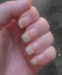 HAIRtamin Vegan Hair Vitamins for Faster Growth | All Natural Biotin Capsules to Support Healthy Hair, Skin and Nails | May Reduce Loss & Thinning | 30 Capsules 1 34 41IB0 sUCVL 2