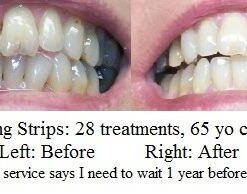 Crest 3D Whitestrips, Glamorous White, Teeth Whitening Strip Kit, 28 Strips (14 Count Pack) Flavorless 28 Count (Pack of 1) 35 41JFp0fEIXL