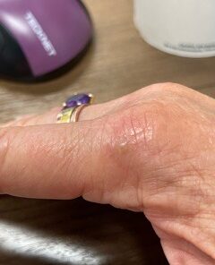 Silver Miracles Colloidal Silver Gel - Nano Silver Gel Wound Care - Healing Ointment for Burns, Sunburns & Irritated Skin - 4 Oz Unscented 33 41Mc6BIeWL