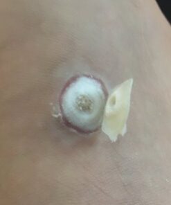 Compound W Maximum Strength Fast Acting Gel Wart Remover, 0.25 oz, 2 Pack unflavored 0.5 Ounce (Pack of 1) 40 41O5lFL5NpL