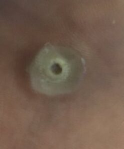 Compound W Maximum Strength Fast Acting Gel Wart Remover, 0.25 oz, 2 Pack unflavored 0.5 Ounce (Pack of 1) 41 41R cbAQtCL