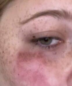 Active Skin Repair Hydrogel - Natural & Non-Toxic First Aid Ointment & Antiseptic Gel for Minor Cuts, Wounds, Scrapes, Rashes, Sunburns, and Other Skin Irritations (Single, 3 oz Gel) 3 Fl Oz (Pack of 1) 49 41WfWrE4 uL