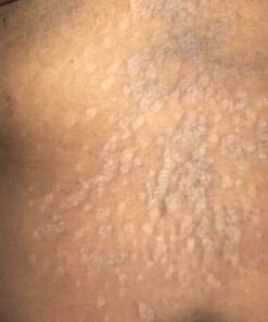 PURELY NORTHWEST-Natural Tea Tree & Peppermint Body Wash for Men & Women-Refreshing Daily Soap for Body Odor & Hygiene, Acne-Effectively Soothes Jock Itch, Chafing & Athletes Foot-Discolored Nails-9oz 9 Fl Oz (Pack of 1) 53 41ZiB5XEU7L