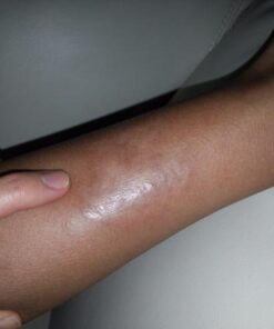 Defense Soap 4.2 Oz Bar - 100% Natural Tea Tree and Eucalyptus Oil Classic 4.2 Ounce (Pack of 1) 21 41aHy3efxzL