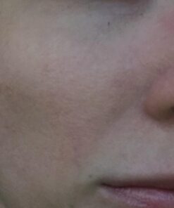 Hyaluronic Acid Serum for Skin 100% Pure Anti Aging Serum Intense Hydration Moisture Non greasy Paraben free, Wrinkle Reducing and Brightening Serum (Pro Formula) 2oz 2 Fl Oz (Pack of 1) 42 41kg FTo5VL