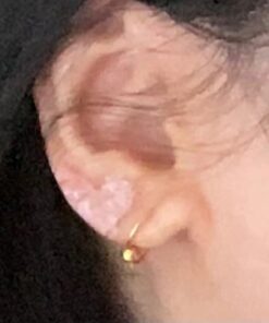 SkinSmart Antimicrobial Eczema Therapy with Hypochlorous Acid, Removes Bacteria so Skin Can Heal, for Adults, Kids and Seniors, 8 Ounce Clear Spray 8 Fl Oz (Pack of 1) 44 41m0kJWpK7L