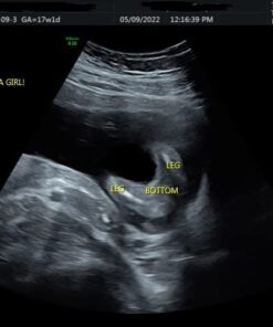SneakPeek® DNA Test Gender Prediction - Know Baby’s Gender at 6 Weeks with 99.9% Accuracy¹ - Lab Fees Included - Early Boy or Girl Reveal Home Kit (Lancet) 38 41pHwyydIZL