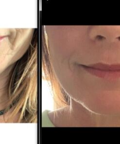 ASTERWOOD NATURALS Triple Repair Matrixyl 3000 + Argireline + Hyaluronic Acid + Organic Vitamin C Serum for Face; Anti-Aging Face Serum, Anti-Wrinkle Serum, Facial Skin Serum Skin Care, 118ml/4 oz Triple Repair - Unscented 4 Fl Oz (Pack of 1) 33 41q3MPeDvOL