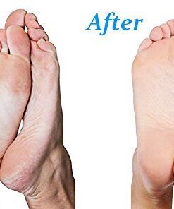 Emjoi Micro-Pedi 3D POWER Callus Remover with Xtreme Coarse Soft & Flexible Roller (Most Powerful & Corded) Blue 1 Count (Pack of 1) 15 41tpPTjJxRL