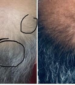 NutraChamps HairFlair | Hair Health Vitamins for Women | Biotin Vitamins for Hair Skin & Nails | Hair Health Supplement for All Hair Types with Biotin, Keratin, Collagen, Bamboo, Aloe & More 38 41vTZpvTHVL