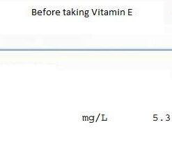 Solgar Vitamin E 268 MG (400 IU) (d-Alpha Tocopherol & Mixed Tocopherols), 100 Softgels - Supports Immune System & Skin Nutrition - Natural Antioxidant - Gluten Free, Dairy Free - 100 Servings 100 Count (Pack of 1) 35 41vsv 1WPbL