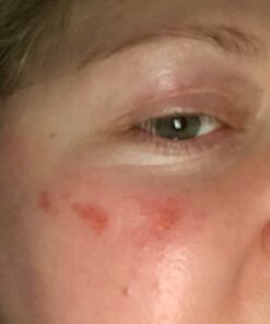 Face Moisturizer for Dry Skin - Facial Moisturizer for Women & Men - Dry Skin Face Moisturizer with Manuka Honey, Aloe Vera & Cehami - Soothing & Redness Relief Face Creams for Sensitive Skin & Eczema 25 51 3HgQyXUL