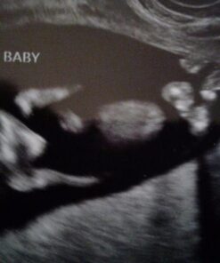 Conceive Plus Fertility Lubricant - Fertility Friendly Lube for Couples Trying to Conceive, 75ml / 2.5 fl oz 36 51 5jbYiteL