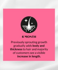 Kerotin Hair Growth Vitamins, Biotin Supplement, DHT Blocker, Collagen Stimulator, for Hair Loss Support, Nail & Skin Care, Includes Saw Palmetto, Vitamin D3 & More - 60 Pills (1 Month Supply) 60 Count (Pack of 1) Capsules 30 51 WnjwIuZL 1