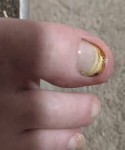 Kerasal Nail Renewal, Restores Appearance of Discolored or Damaged Nails, 0.33 fl oz (Packaging May Vary) 33 5107lw8DdL