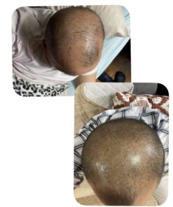 PURA D'OR Deep Moisturizing Biotin Conditioner (16oz) Thickens, Softens, & Moisturizes Dry, Frizzy, Damaged Hair w/Argan Oil, Pumpkin, Rosemary, Honeysuckle, Vitamin E, Men Women (Packaging may vary) 16 Fl Oz (Pack of 1) 41 510YuuhSJLL