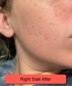 Silver Miracles Colloidal Silver Gel - Nano Silver Gel Wound Care - Healing Ointment for Burns, Sunburns & Irritated Skin - 4 Oz Unscented 50 510wJbzXZSL 1