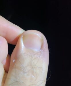 Fungi Nail Anti-Fungal Ointment, Kills Fungus That Can Lead to Nail & Athlete’s Foot with Tolnaftate & Clinically Proven to Cure Infections, Natural Color, 0.7 Fl Oz 37 510y5B6SzPL