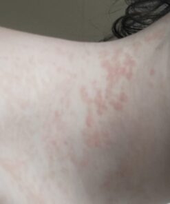 Truremedy Naturals Remedy Tea Tree Oil Body Wash - Body Wash That Helps Body Odor, Ringworm, & Skin Irritations - Tea Tree Soap Body Wash (1 pk, 12 oz) 12 Fl Oz (Pack of 1) 45 511MGXGz25L 1