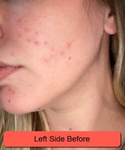 Silver Miracles Colloidal Silver Gel - Nano Silver Gel Wound Care - Healing Ointment for Burns, Sunburns & Irritated Skin - 4 Oz Unscented 51 511lW0XXshL