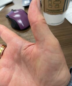 Silver Miracles Colloidal Silver Gel - Nano Silver Gel Wound Care - Healing Ointment for Burns, Sunburns & Irritated Skin - 4 Oz Unscented 34 513HKeR1CbL