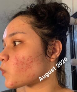 Paulas Choice--SKIN PERFECTING 2% BHA Liquid Salicylic Acid Exfoliant--Facial Exfoliant for Blackheads, Enlarged Pores, Wrinkles & Fine Lines, 4 oz Bottle 4.00 Fl Oz (Pack of 1) 33 518QwT9WagL