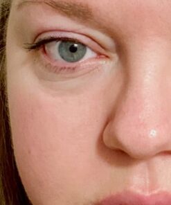 Face Moisturizer for Dry Skin - Facial Moisturizer for Women & Men - Dry Skin Face Moisturizer with Manuka Honey, Aloe Vera & Cehami - Soothing & Redness Relief Face Creams for Sensitive Skin & Eczema 26 519j6JxZiLL