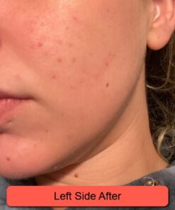 Silver Miracles Colloidal Silver Gel - Nano Silver Gel Wound Care - Healing Ointment for Burns, Sunburns & Irritated Skin - 4 Oz Unscented 52 51Btq8PqJnL