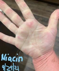 NOW Supplements, Niacin (Vitamin B-3) 500 mg, Essential B-Group Vitamin*, Nutritional Health, 100 Capsules 100 Count (Pack of 1) 23 51CGefvKlmL