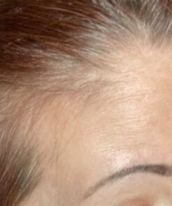 Hairgenics Pronexa Clinical Strength Hair Growth & Regrowth Therapy Hair Loss Shampoo With Biotin, Collagen, and DHT Blockers for Thinning Hair, 8 fl. oz. 53 51Ck576EXPL