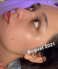 Paulas Choice--SKIN PERFECTING 2% BHA Liquid Salicylic Acid Exfoliant--Facial Exfoliant for Blackheads, Enlarged Pores, Wrinkles & Fine Lines, 4 oz Bottle 4.00 Fl Oz (Pack of 1) 34 51DHc2V8MTL