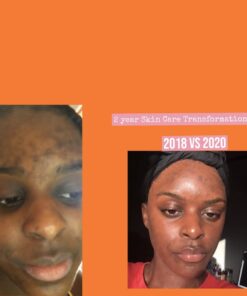 5 Pack of Dudu Osun Black Soap 30 51E72TgbqL