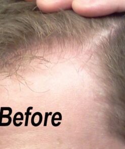 Maxx Beard -#1 Beard Growth Solution, Natural Solution for Maximum Beard Volume-2 Month Supply 24 51FtZebYdvL