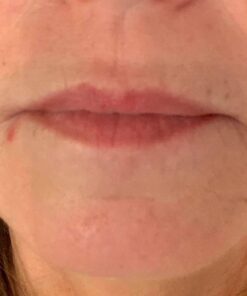 ASTERWOOD NATURALS Triple Repair Matrixyl 3000 + Argireline + Hyaluronic Acid + Organic Vitamin C Serum for Face; Anti-Aging Face Serum, Anti-Wrinkle Serum, Facial Skin Serum Skin Care, 118ml/4 oz Triple Repair - Unscented 4 Fl Oz (Pack of 1) 34 51GXplnyM4L