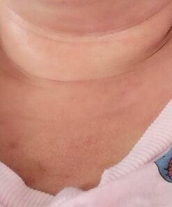 Aidance Skincare & Topical Solutions terrasil Anti-fungal Treatment MAX - 50g 25 51GZGDTe0rL