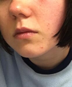 RoC Retinol Correxion Deep Wrinkle Anti-Aging Night Cream, Daily Face Moisturizer with Shea Butter, Glycolic Acid and Squalane, Skin Care Treatment, 1 Ounces 1 Fl Oz (Pack of 1) 49 51IGEpV3GL 3