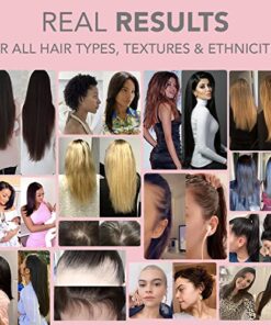 HAIRtamin MOM Vegan Prenatal & Postnatal Multivitamin Supplement & Hair Vitamin Pregnancy, Postpartum, Breastfeeding Probiotic One-a-Day Hair Vitamins with Biotin, Zinc, Iron (30 Counts) 30 Count (Pack of 1) 13 51KOXxz9 ML