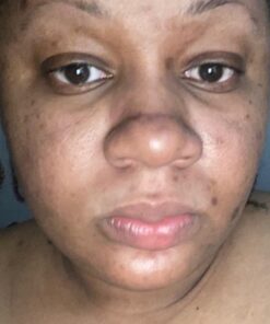 YEOUTH Glycolic Acid Peel for Face Professional 30% Gel with Retinol & Green Tea, Chemical Peel for Face at Home for Wrinkles, Dark Spots & Acne, Skin Care Chemical Exfoliant, Glycolic Acid Serum Glycolic 30% Peel 1oz 35 51MnyV6W yL 1