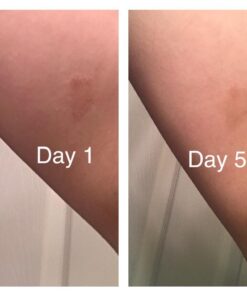 Silver Miracles Colloidal Silver Cream - 4oz - Colloidal Silver Skin Healing Cream - Scent And Dye Free - Moisturizes Dry Skin - Made With 99.999% Pure Silver 19 51N9TwA5YfL