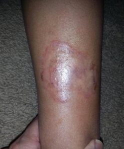 Defense Soap 4.2 Oz Bar - 100% Natural Tea Tree and Eucalyptus Oil Classic 4.2 Ounce (Pack of 1) 22 51OVtVNig3L