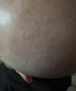 Head Shaver for Bald Men,5 in 1 Bald Head Shavers for Men Cordless,Waterproof Wet/Dry 5 Head Mens Electric Razor for Head Face Shaving, USB Mans Grooming Kit Rechargeable,Rotary Shaver Gift for Men 36 51OzQPkdP7L