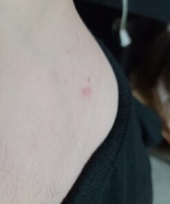 Compound W Nitrofreeze | Wart Removal | 1 Pen & 5 Replaceable Tips 62 51P qc1zpHL