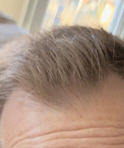 Nutrafol Men's Hair Growth Supplements, Clinically Tested for Visibly Thicker Hair and Scalp Coverage, Dermatologist Recommended - 1 Month Supply 55 51PeS TE2L