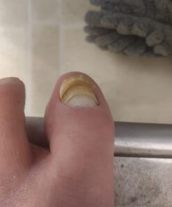 Kerasal Nail Renewal, Restores Appearance of Discolored or Damaged Nails, 0.33 fl oz (Packaging May Vary) 34 51Pln0 7MPL