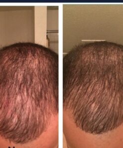 DHT Blocker Supplement & Hair Supplement - Hair Growth Vitamins for Women & Men - DHT Pills Hair Loss Treatments for Women with Saw Palmetto - Hair Regrowth Treatment 60 Count (Pack of 1) 30 51Pnlt5nUtL 2